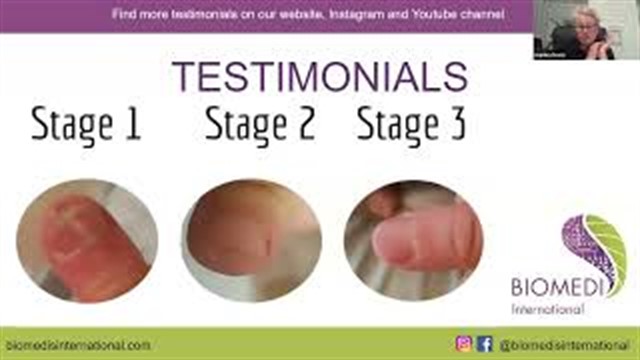 Skin Healing with Oreon (Breon)